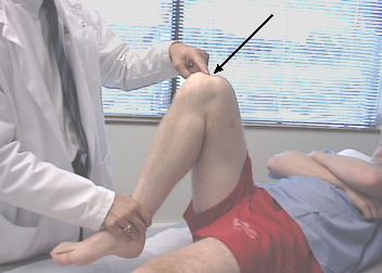 Бол у колену током флексије је најчешћи разлог због којег људи посећују трауме докторе. 