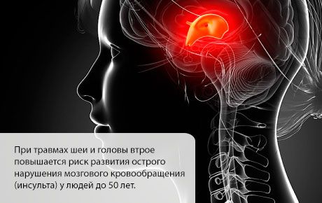 Вероватноћа можданог удара се повећава у првим месецима након повреде главе или врата